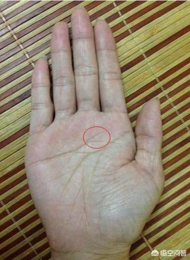 手纹与肝胆健康