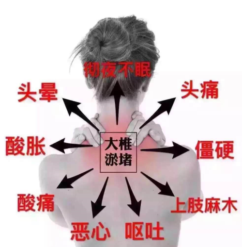 颈椎病的症状详解识别与应对
