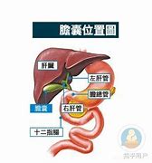 胆囊炎的警示信号了解这些关键症状