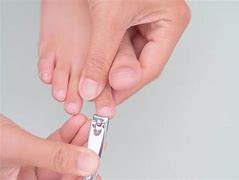 专家观点治疗灰指甲的偏方是否有效？
