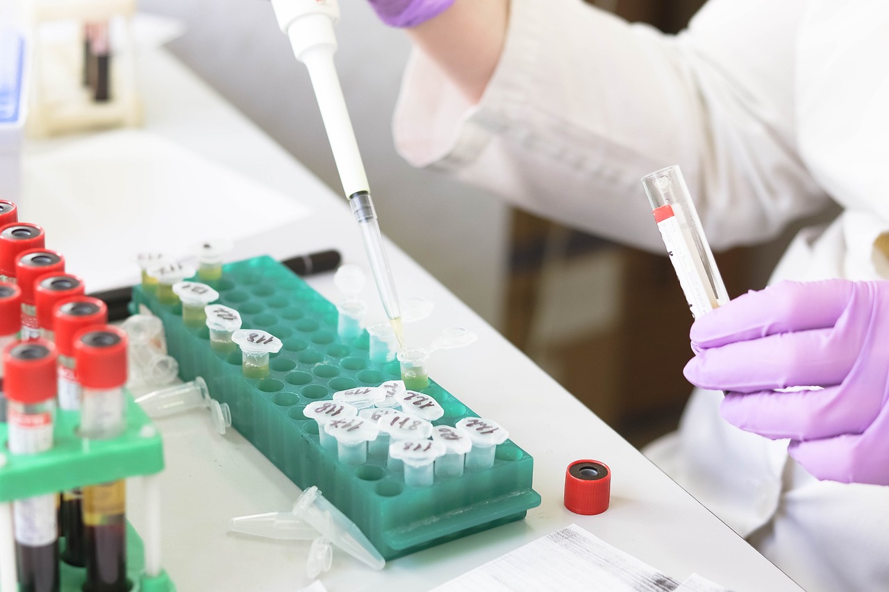深度解析，心电图导联——解读生命电波的科学指南