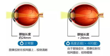 1.定期眼部检查